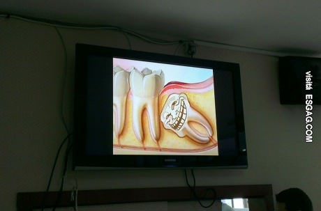 La maldad personificada en una muela