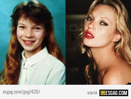 Kate Moss el antes y el despues