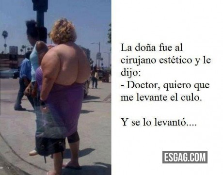 El cirujano plastico hizo lo que le pdieron